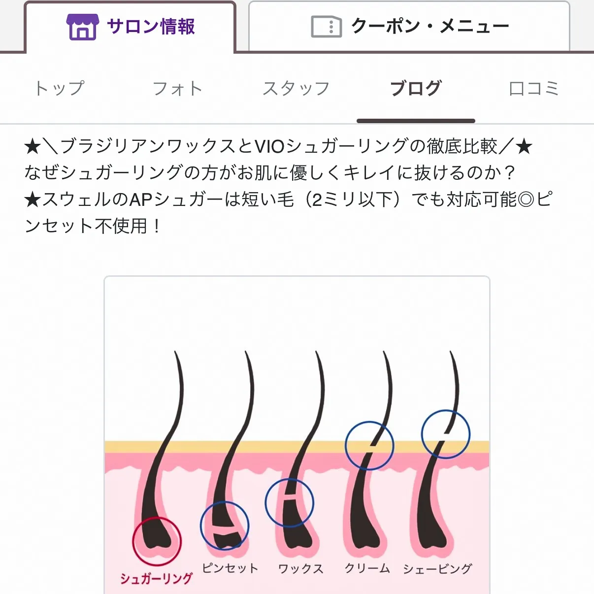 メンズ脱毛でお客様、ご来店いただきました！✨初めてのシュガー...